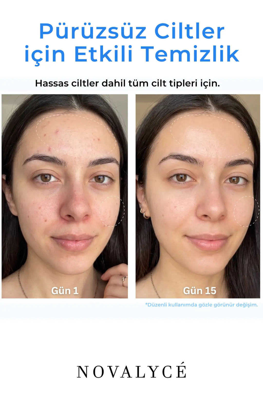 Facial Cleanser Gel Arındırıcı Nemlendirici Yüz Temizleme Jeli | Sodium PCA & Panthenol