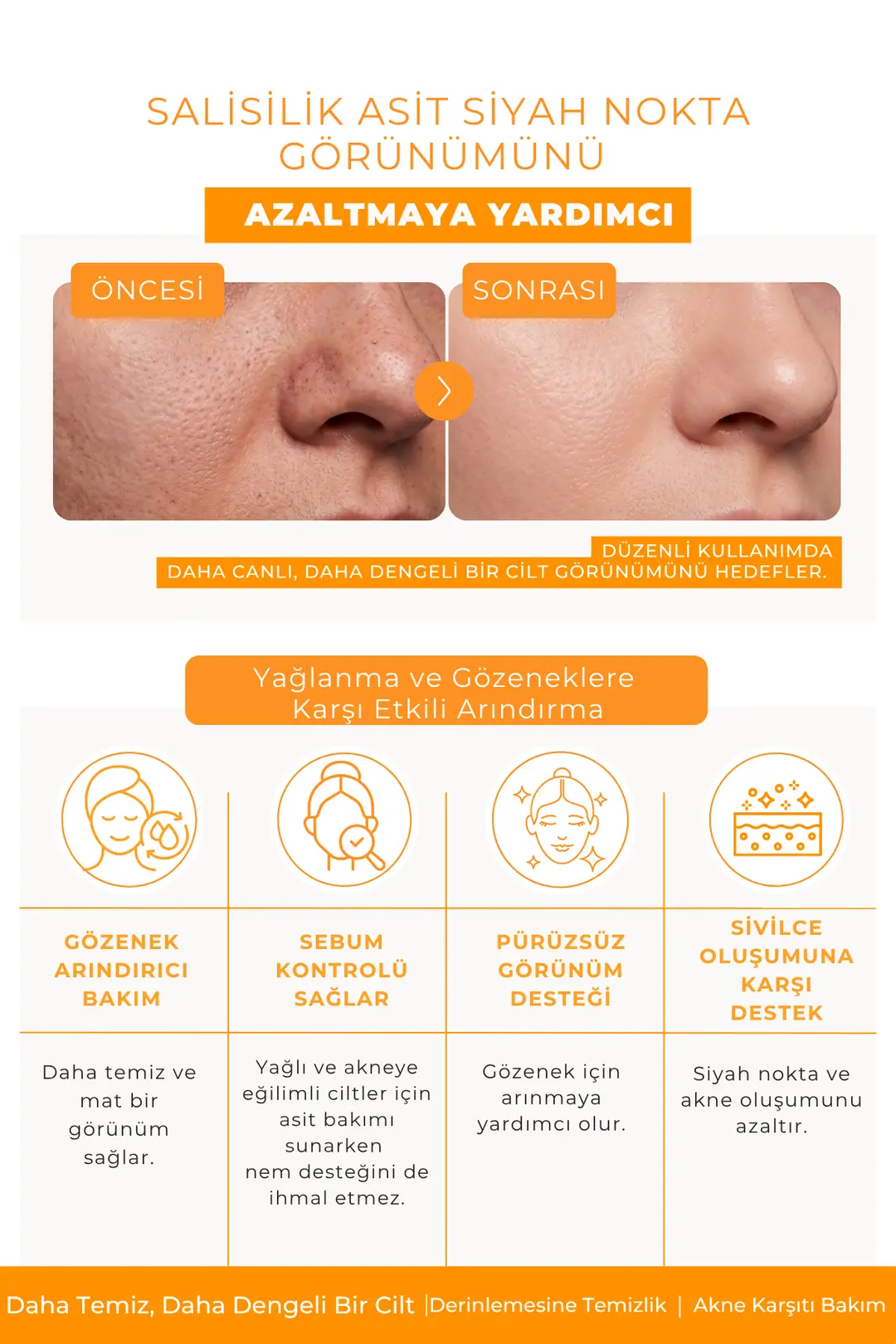 Salicylic Acid Toner Ve Siyah Nokta Karşıtı Yağlı ve Akneye Eğilimli Ciltler İçin