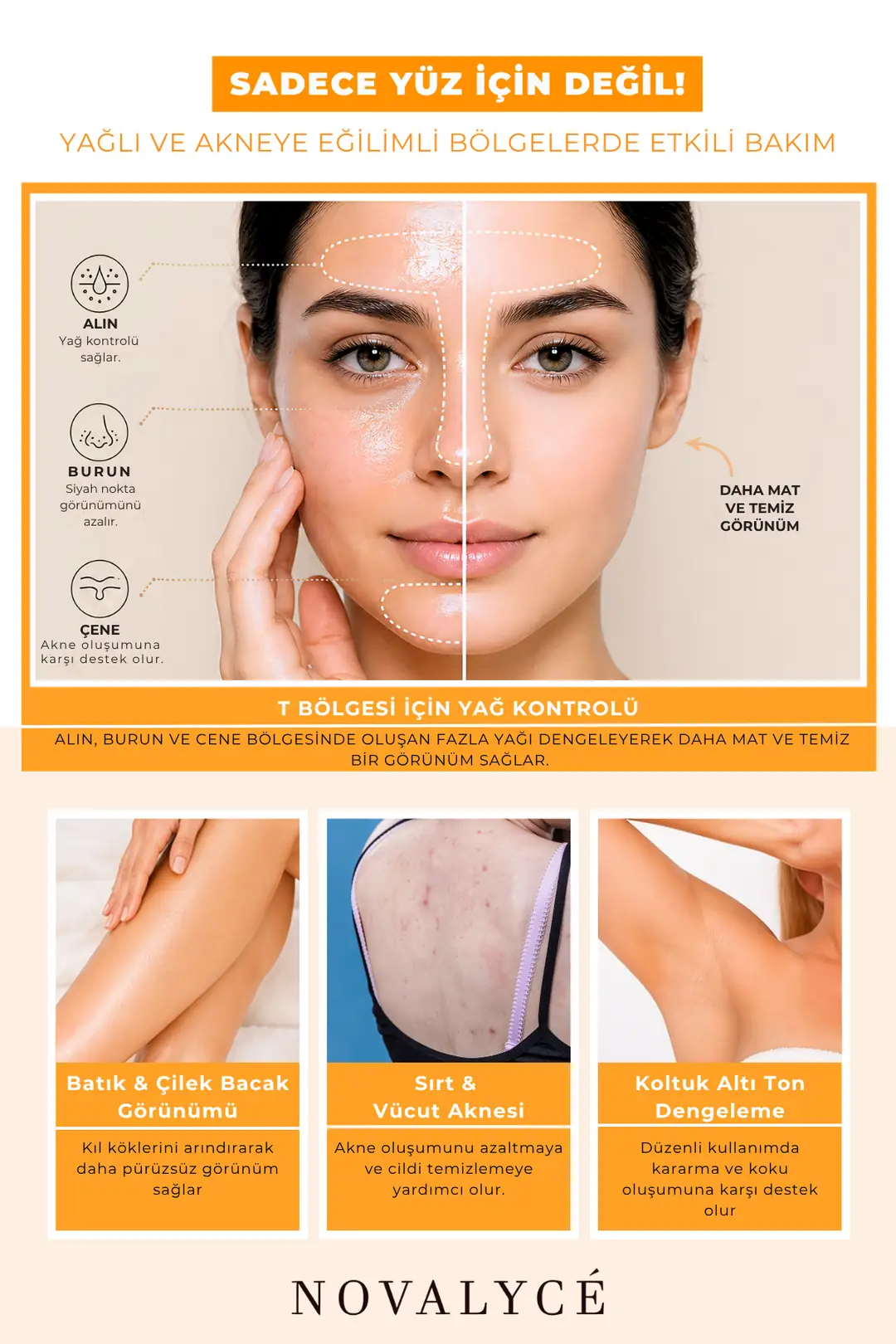 Salicylic Acid Toner Ve Siyah Nokta Karşıtı Yağlı ve Akneye Eğilimli Ciltler İçin